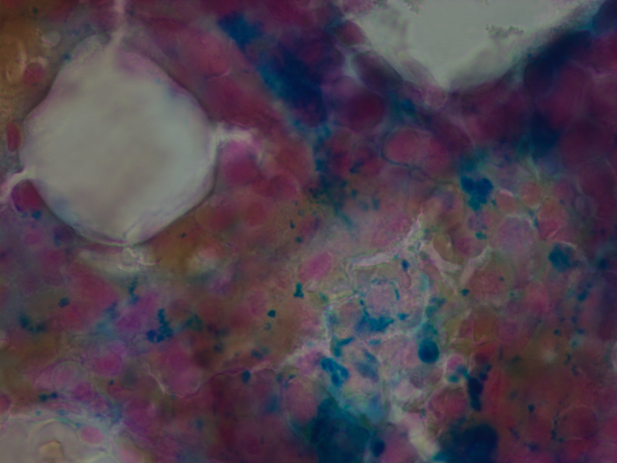 Iron stain on Bone marrow 10222012